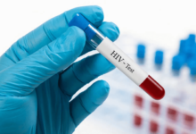 Why a Same-Day HIV Test in Dubai Could Be a Lifesaver