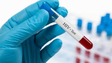 Why a Same-Day HIV Test in Dubai Could Be a Lifesaver