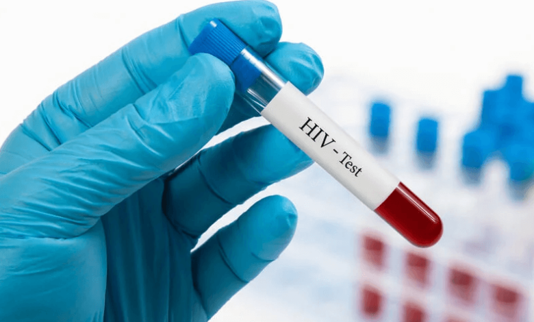 Why a Same-Day HIV Test in Dubai Could Be a Lifesaver
