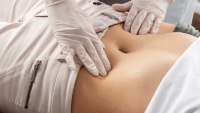 Is a Tummy Tuck in Dubai Worth Considering for a Flatter Abdomen?